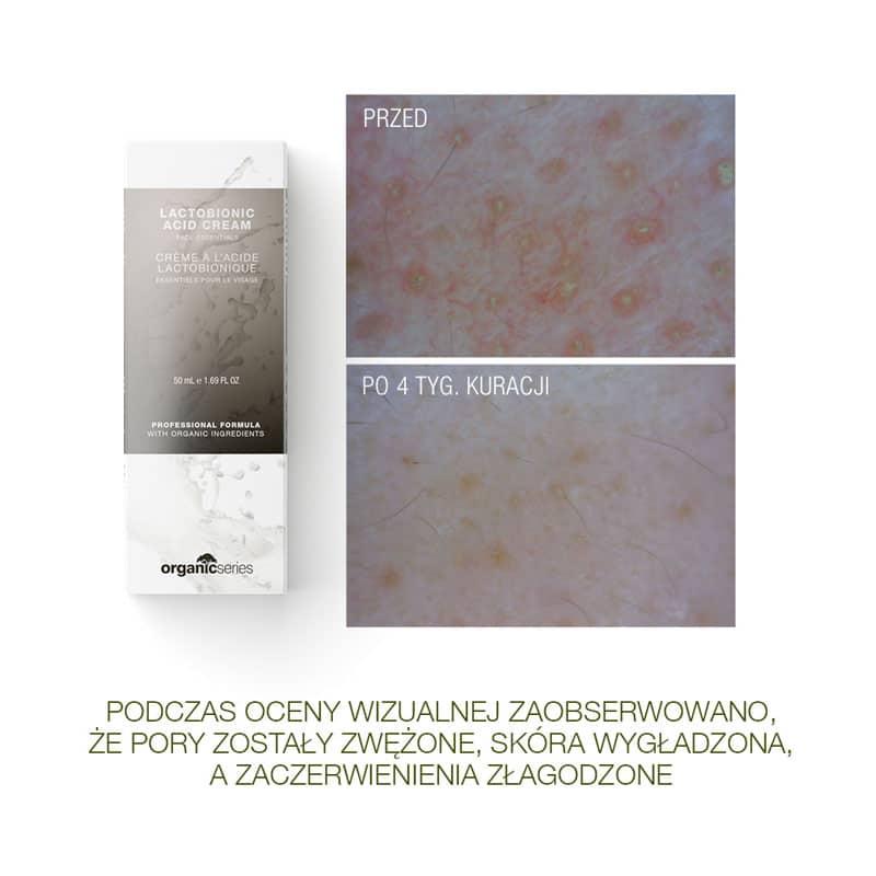 BASICLAB Antyoksydacyjne serum regenerujące odżywienie i wygładzenie 30ml