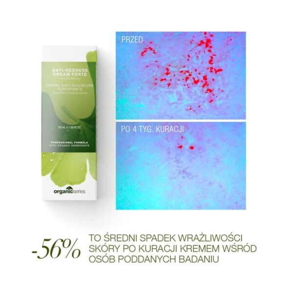 Organic Series Krem forte do cery naczynkowej 50ml